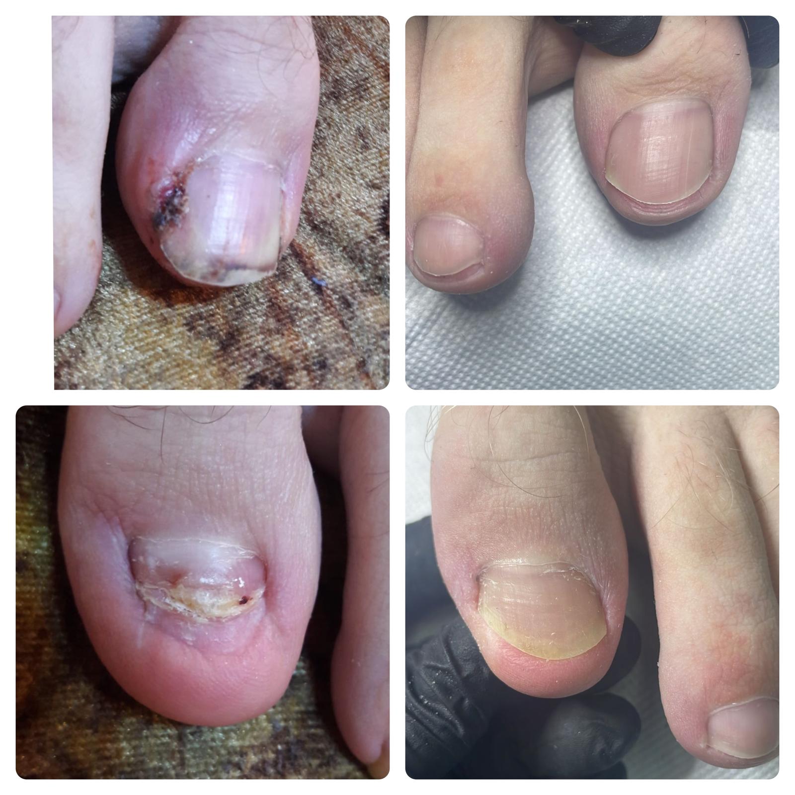 Before and after - rezultat 1